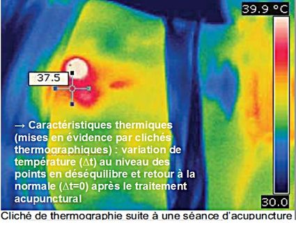 Thermographie3