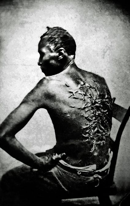 647px Cicatrices de flagellation sur un esclave retouch2