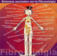 Síntomas de la fibromialgia