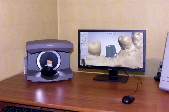 Laboratoire de prothèse dentaire Dollé Céfaï scanner 3D  3 schape