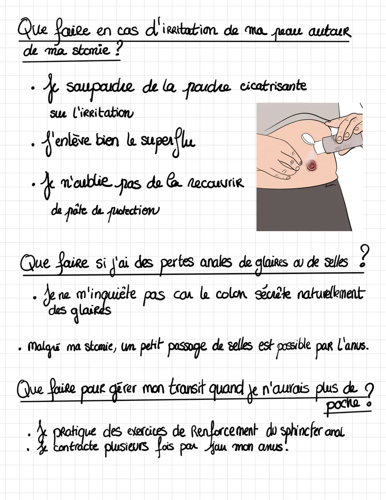 Livret ile ostomie 16