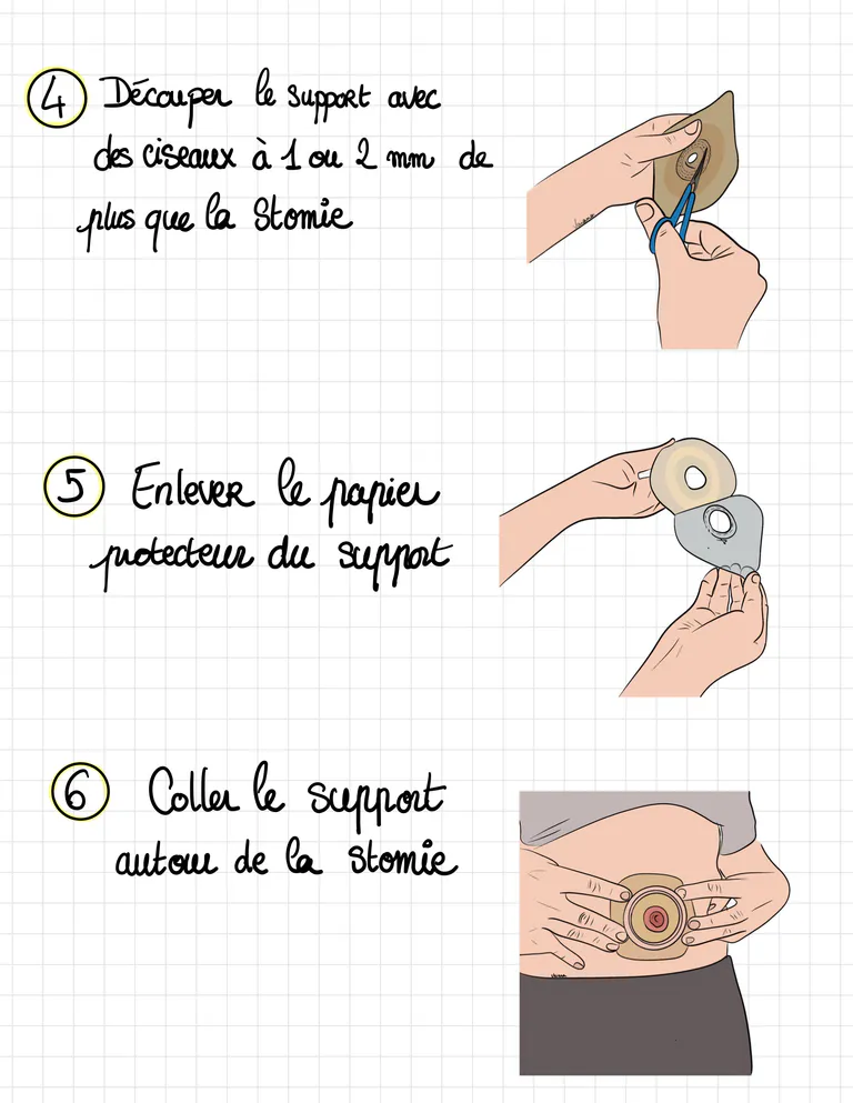 Livret ile ostomie 05