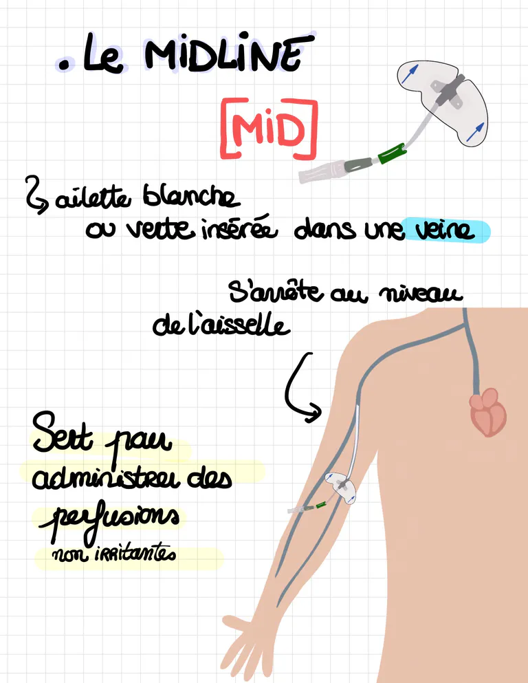Les diffe rentes voies d abords vasculaires 6