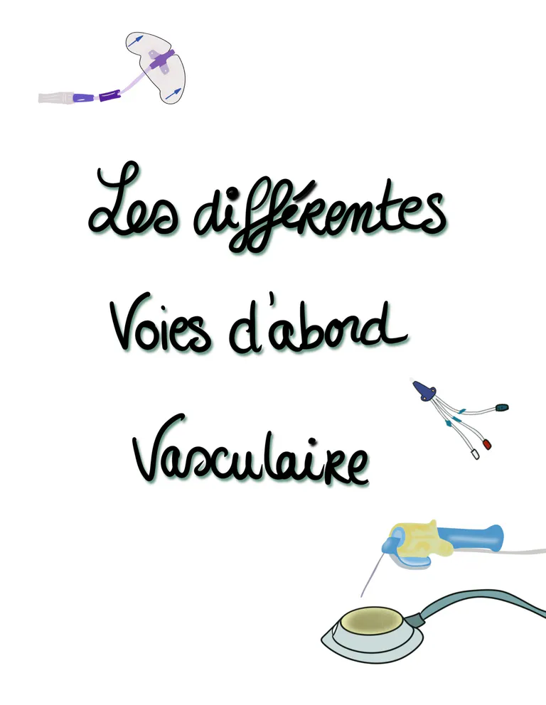 Les diffe rentes voies d abords vasculaires 1