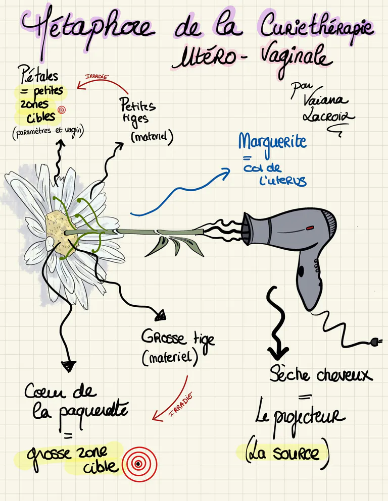 Me taphore curiethe rapie uterovaginale 1