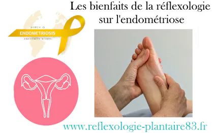 L’endométriose et  la réflexologie