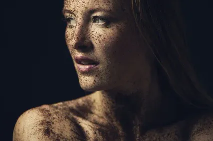 Naturopathe blain visio lupus
