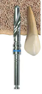 Implant3