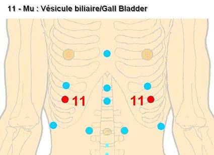11 mu vesicule biliaire gall bladder