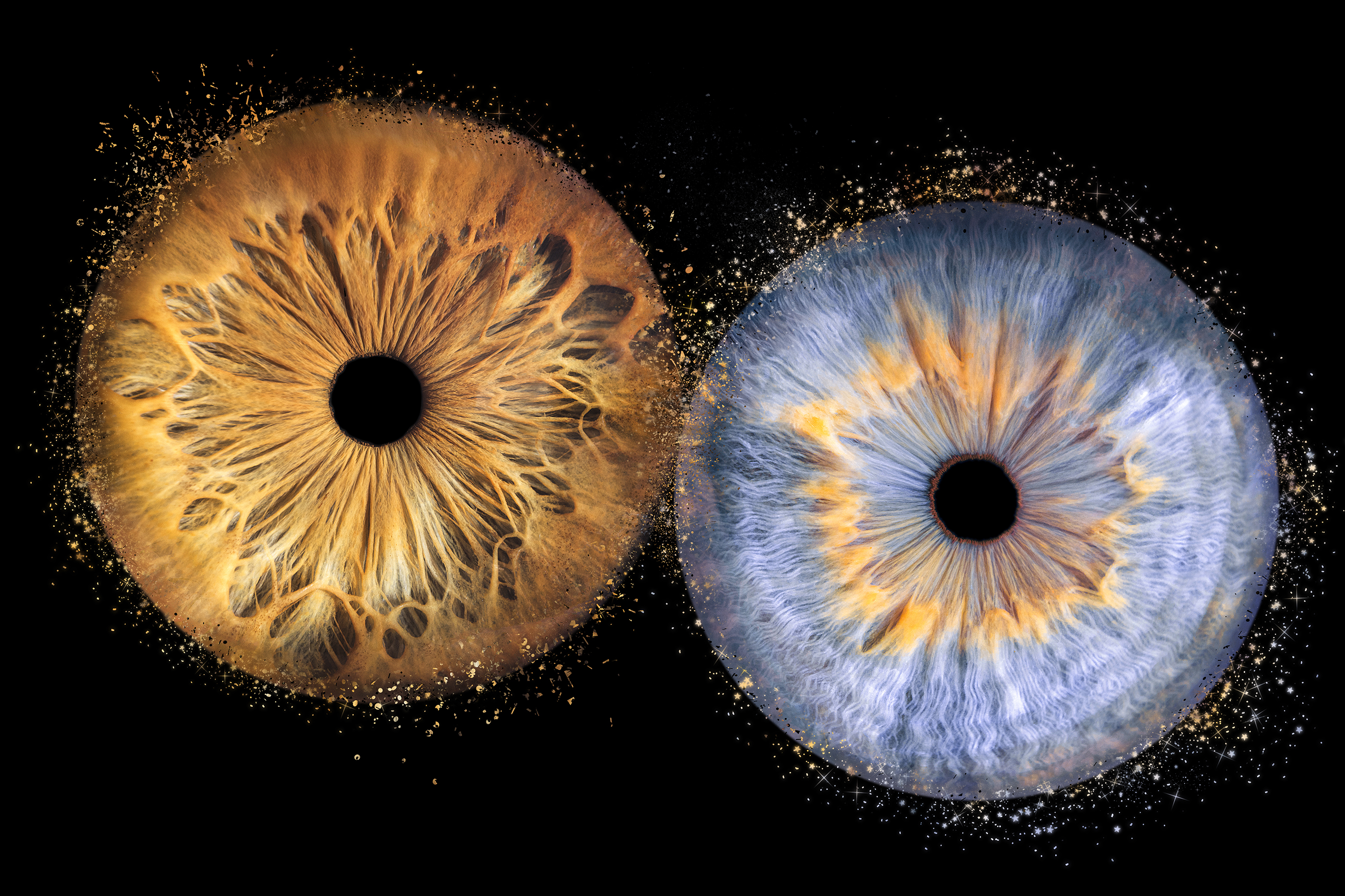 Iris-cantal-1-e