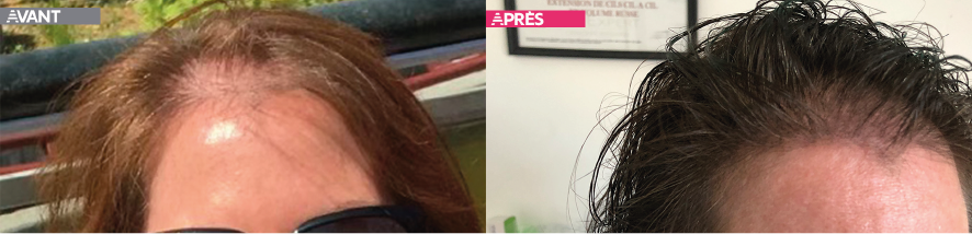 Avant-apres-trico plan-de-travail-1