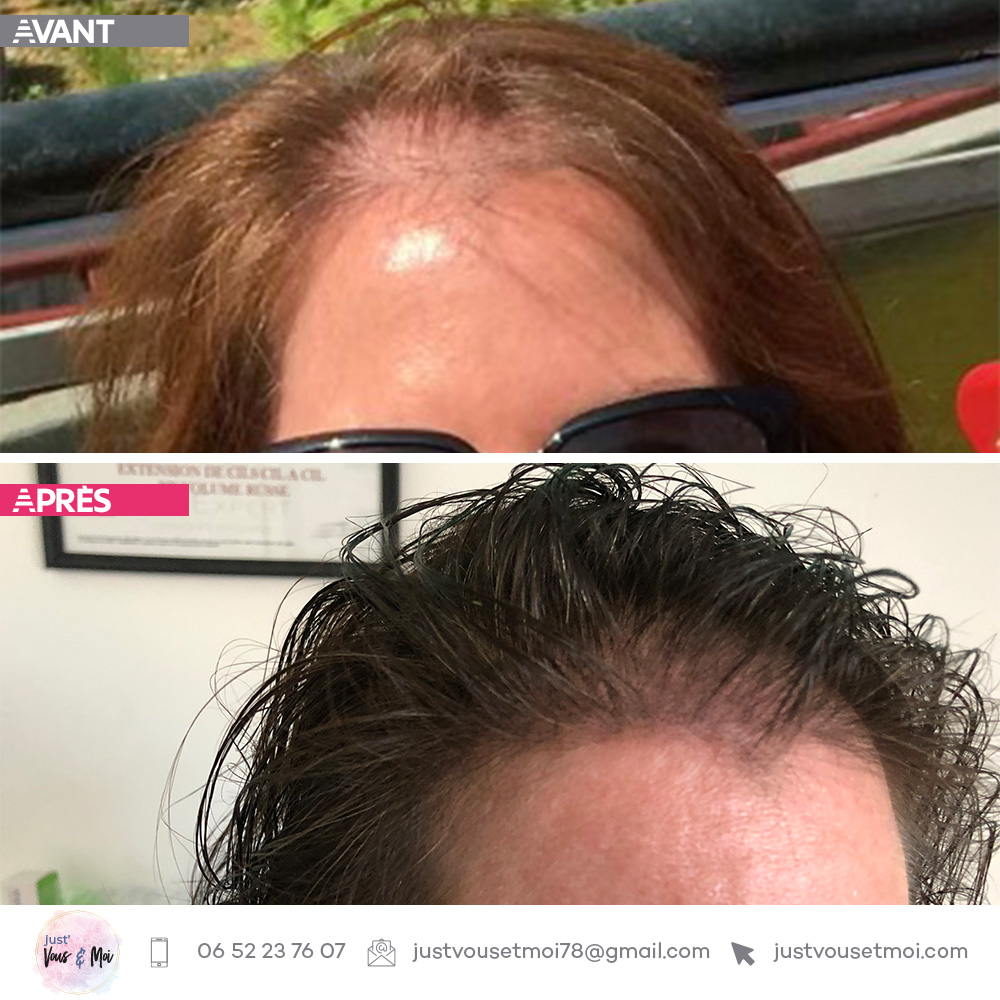 Avant-apres 1000x1000 just-entre-vous-et-moi trico