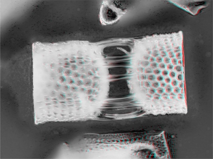 Stephanopyxis-40x-3D-Gerard-Wastiaux-1600x1200-
