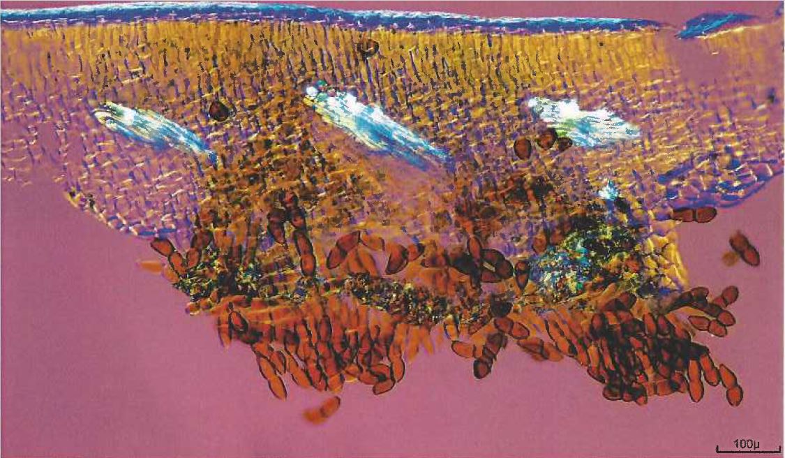 Pierre gatel cylindrocladium buxicola champignon parasite du buis ct d une feuille parasitee