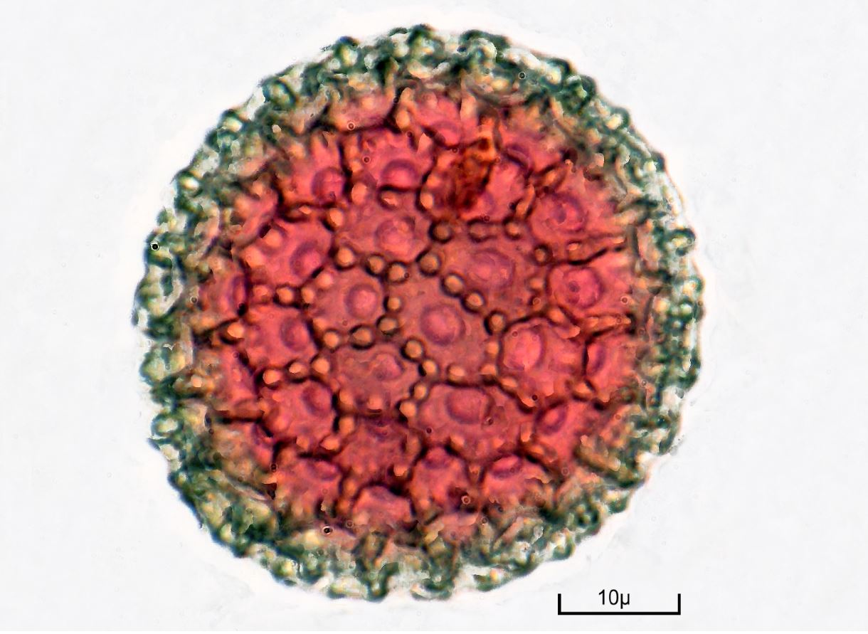 Bernard allard pollen de tribule terrestre obj x40 picolay 27 photos eosine bleu de methylene