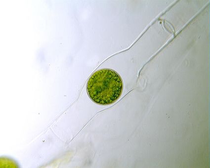 Christian grassin spirogyre zygosspore 1