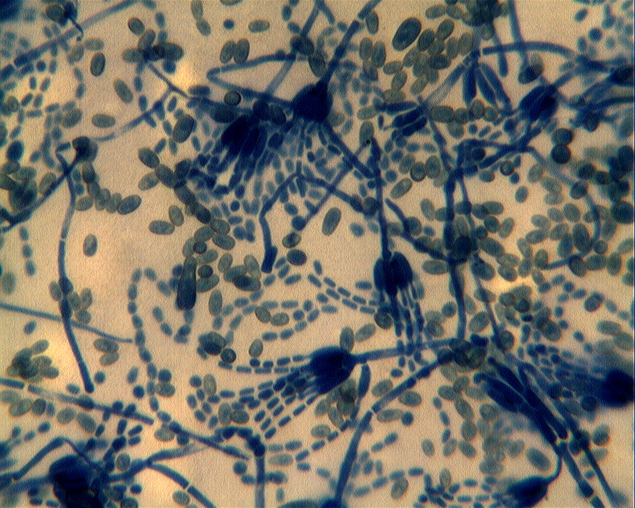 Christian grassin moisissure penicillium sur orange