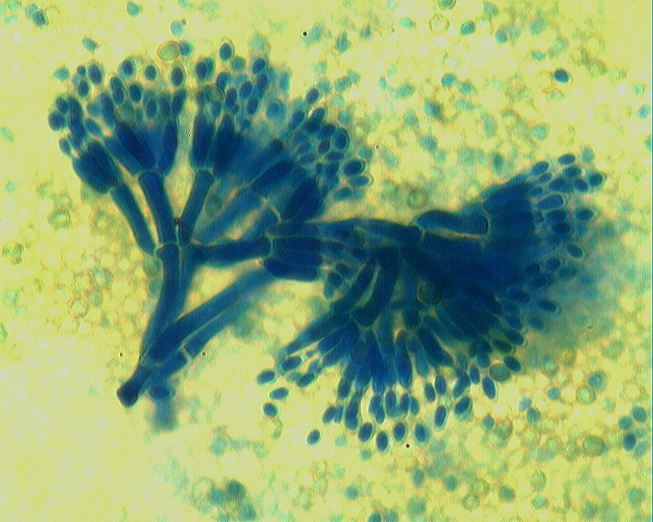 Christian grassin moisissure byssochlamys x63