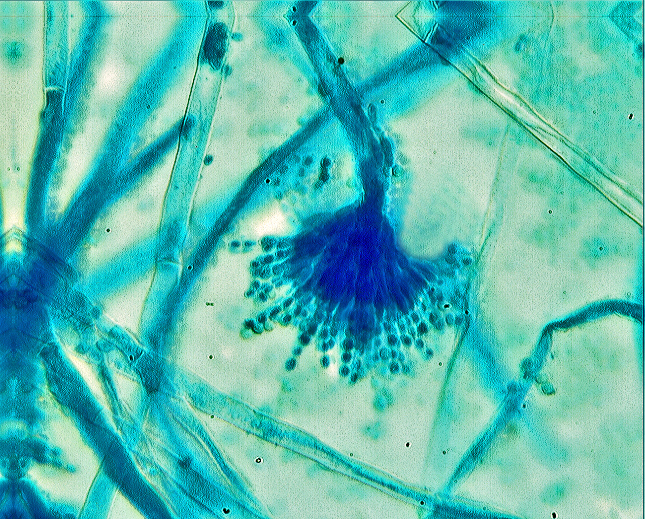Christian grassin aspergillus