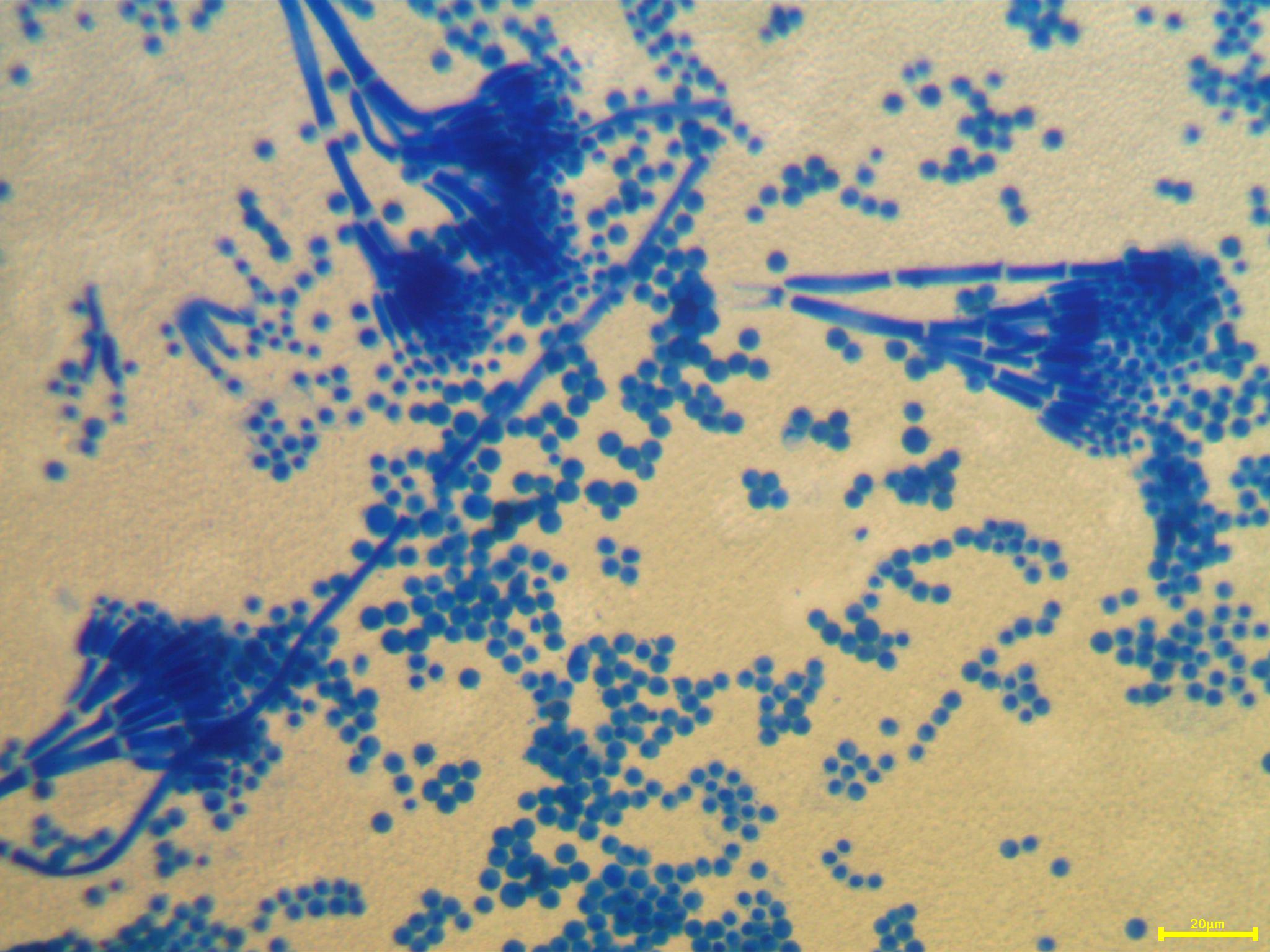 Christian grassin penicillium x40
