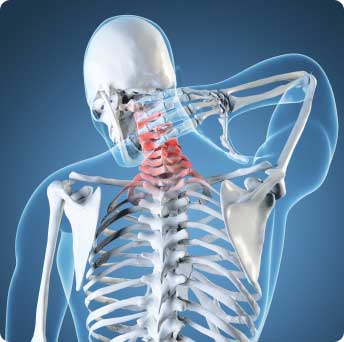Image osteo 03