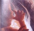 Foetus