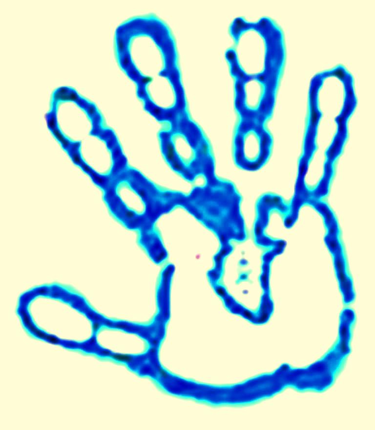 Kirlian maingdeMieux