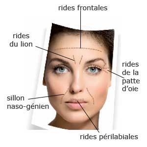 Phyderma definition des rides