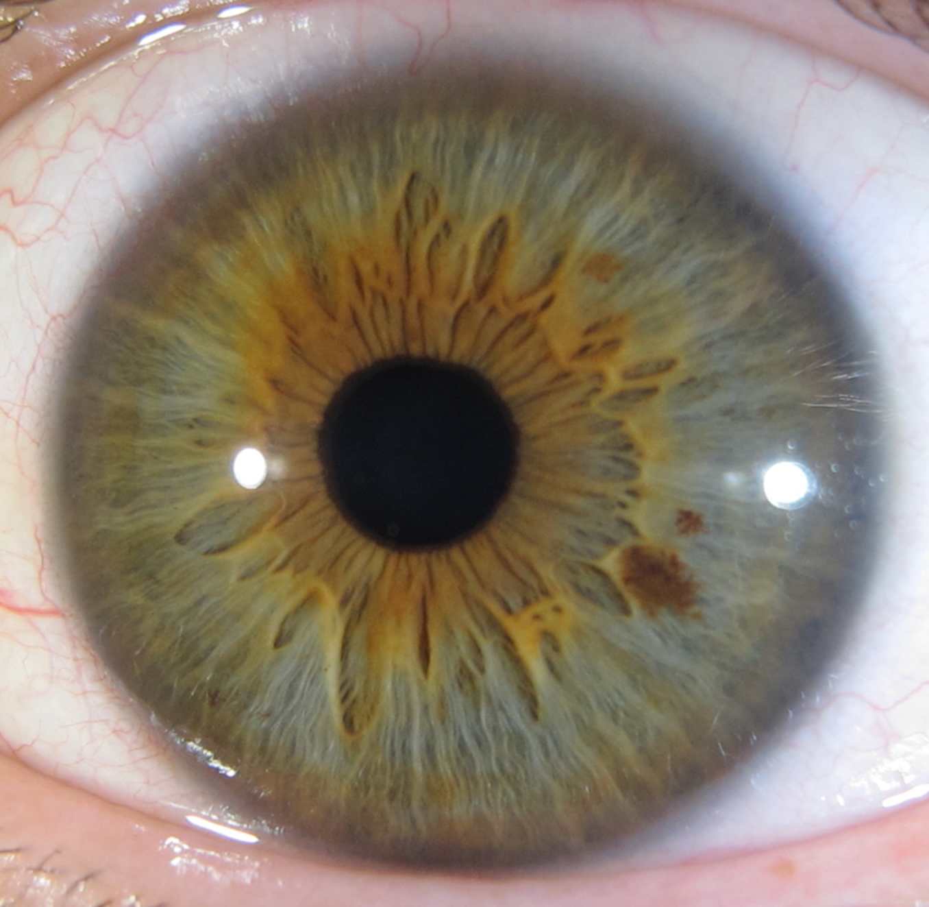 IrisGregG 1 