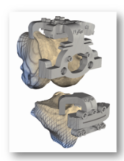 Guidefemurtibia