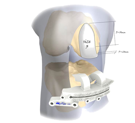 Mykneeuni