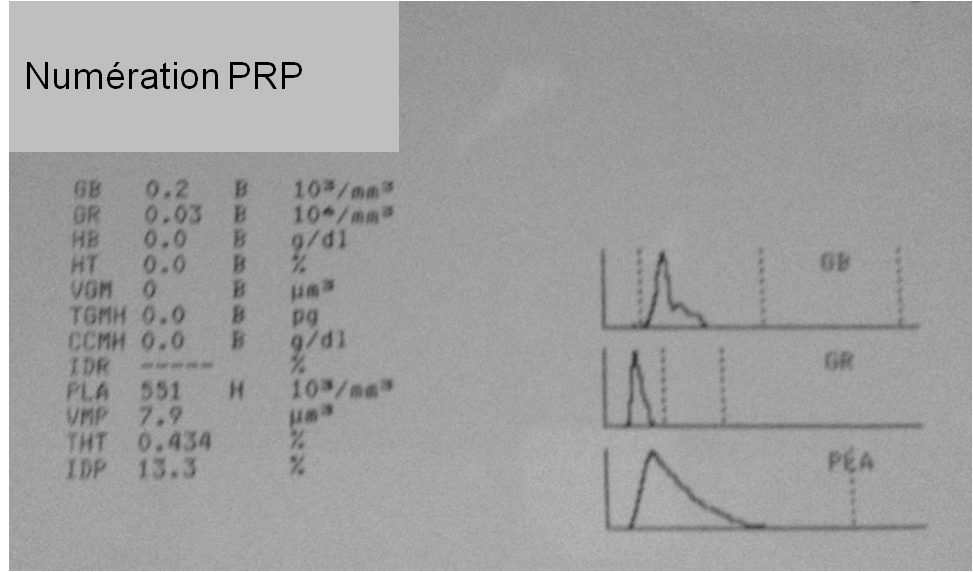 Numeration Prp