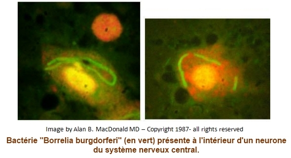 Bb inside neurone 