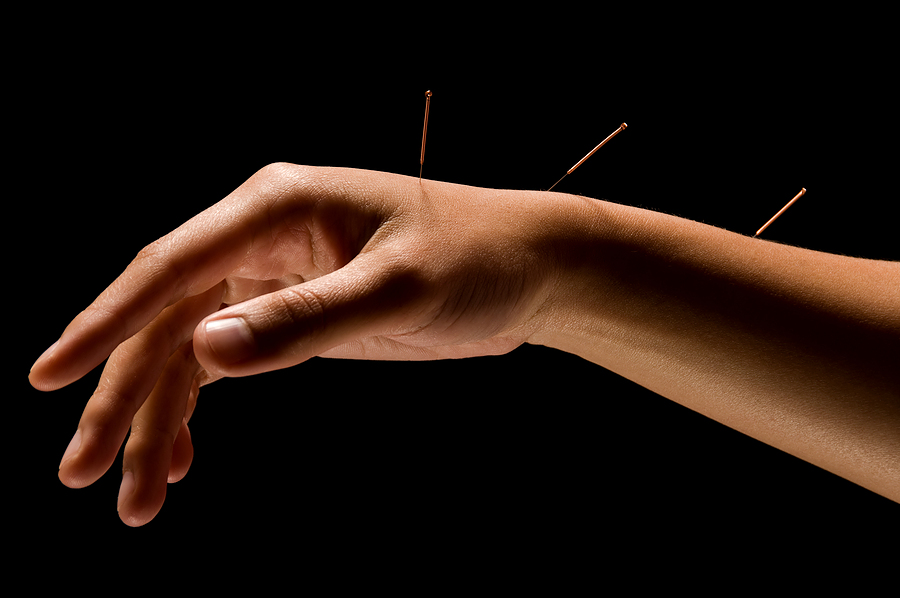 Acupuncture