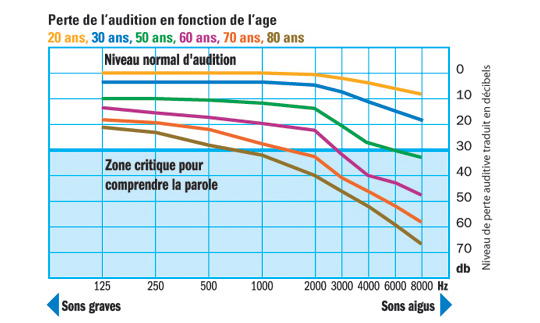 Perte d audition