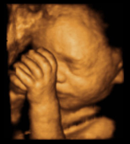 Foetus 3d