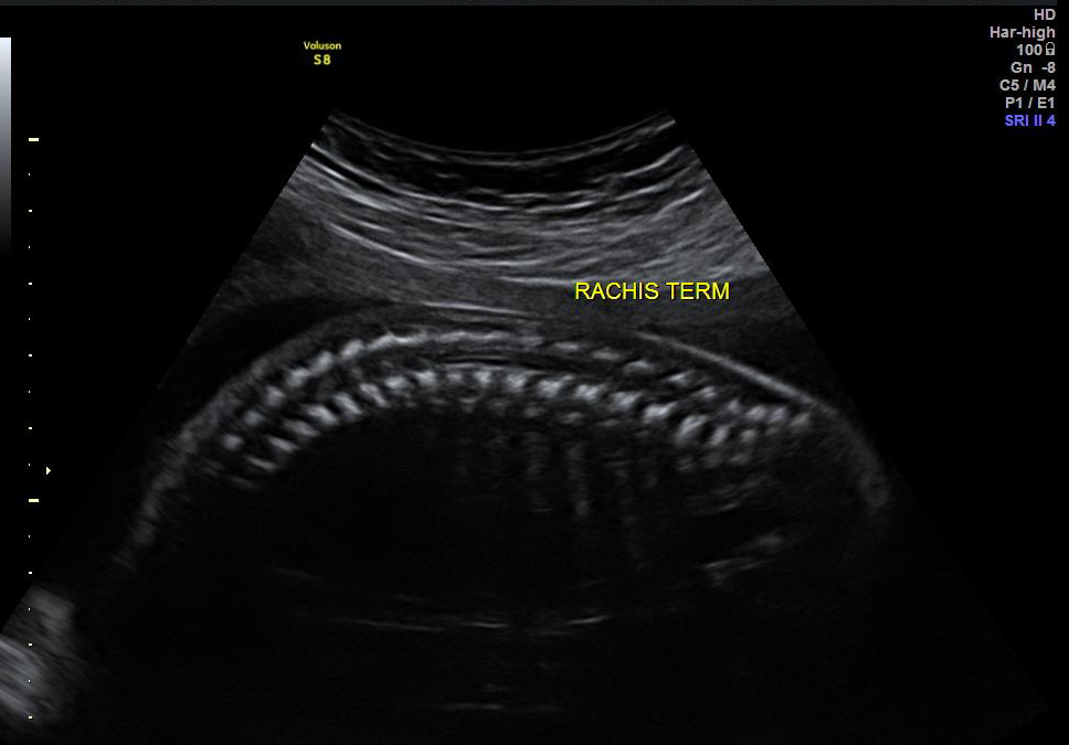 Rachis