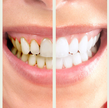 2sourires