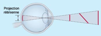 Trois objets différents peuvent produire une image rétinienne similaire