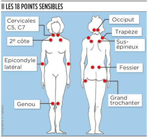 Douleur3