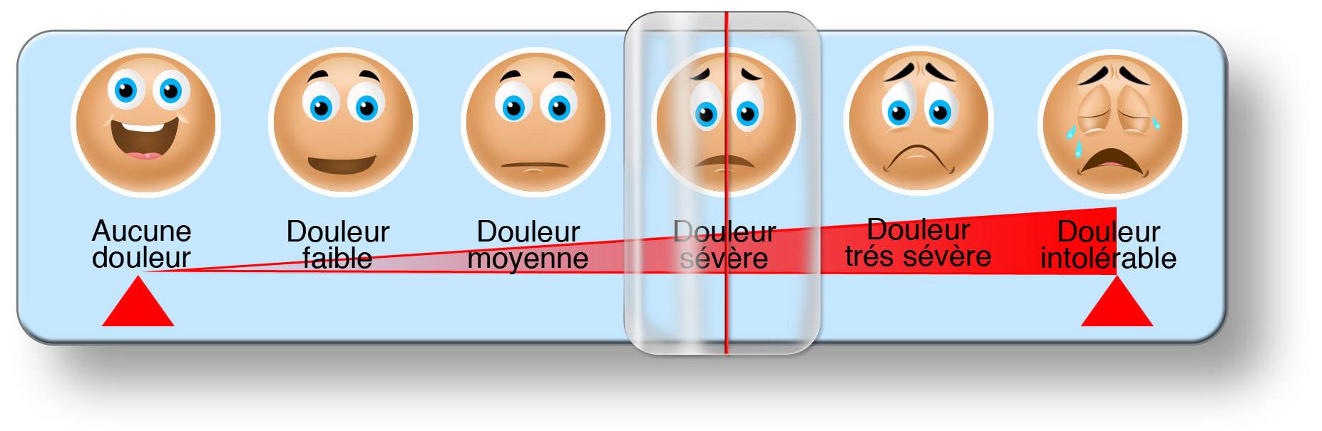 Echelle douleur