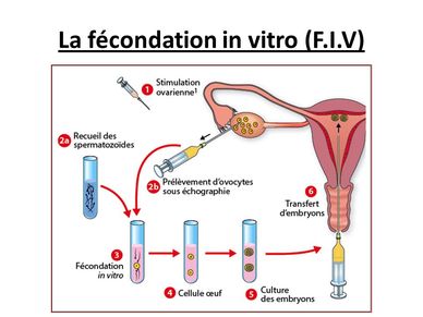 http://slideplayer.fr/slide/5441226/17/images/4/La+f%C3%A9condation+in+vitro+(F.I.V).jpg