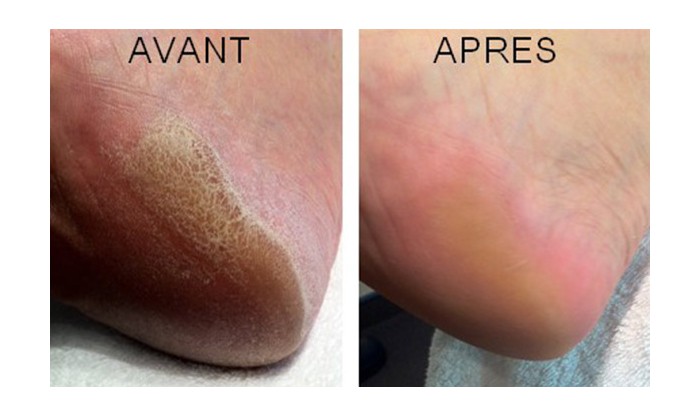 Retrouvez la douceur des pieds de bebe avec yumi feet beauty spa