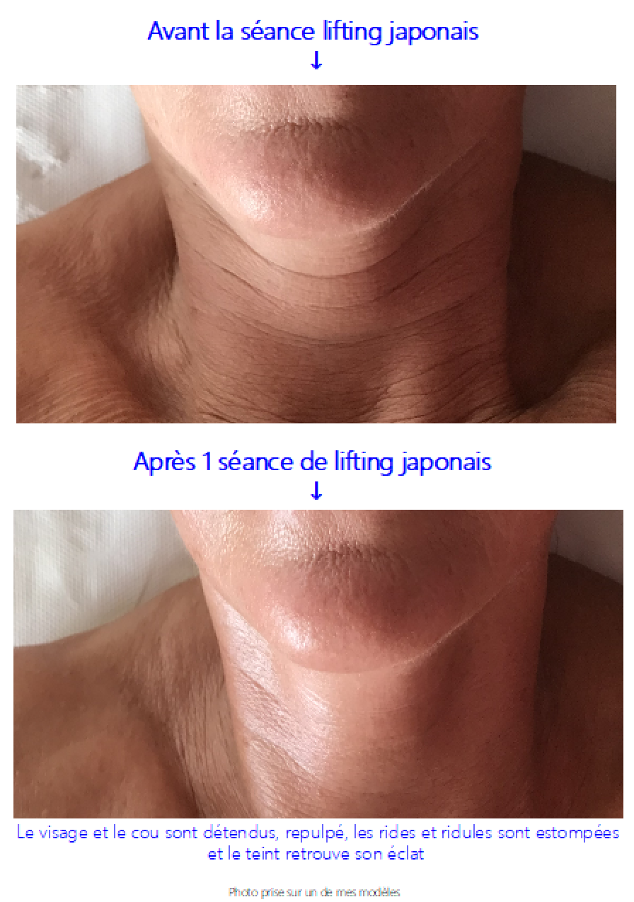 Avant apres cathy