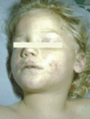 Pneuaap001 1 
