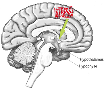 Hypnoseshe ma stress