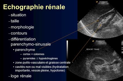 Echographie renale situation taille morphologie contours