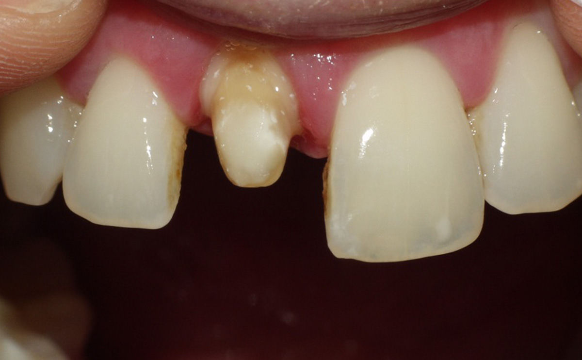 P3310977