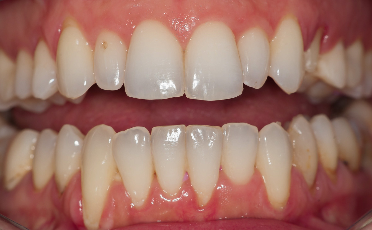 Dsc 8495
