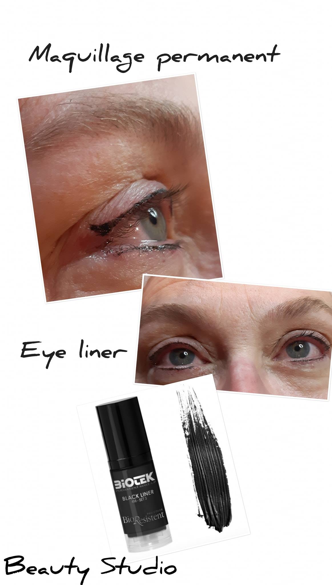 Liner